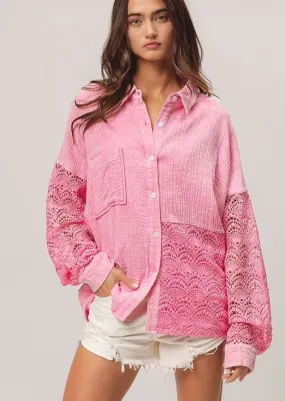 Oversized Gauze Lace Top